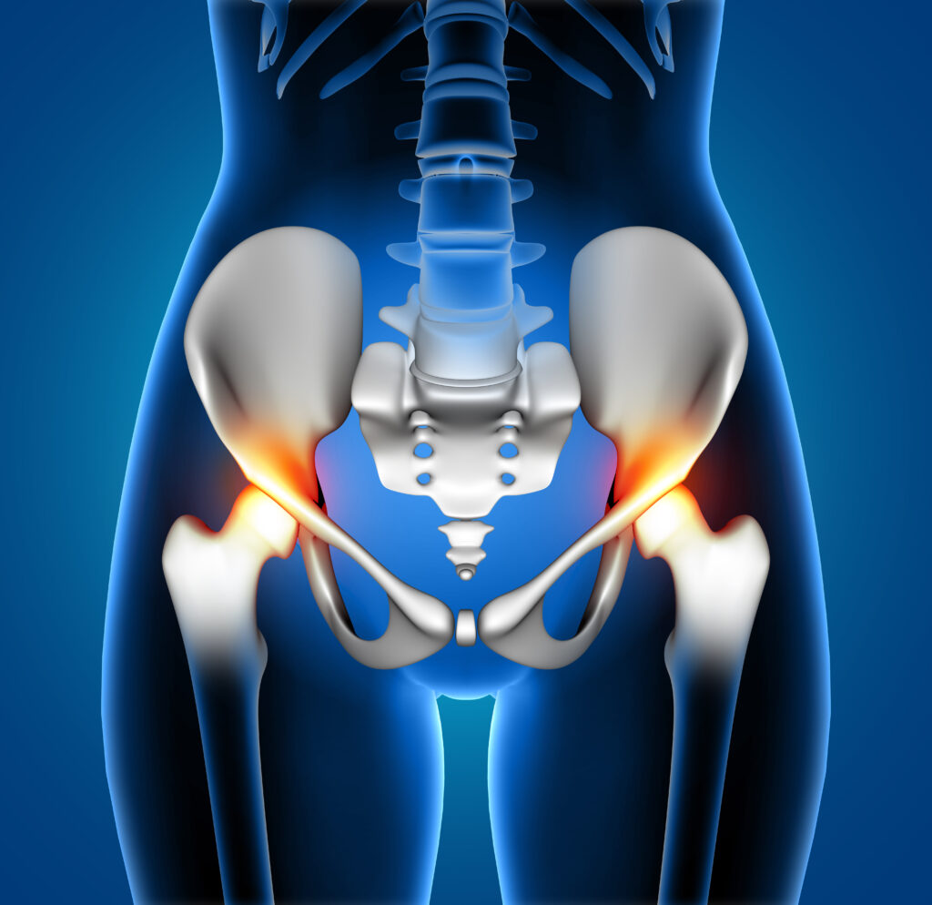 read for everything you should know about total hip replacement surgery and physical therapy